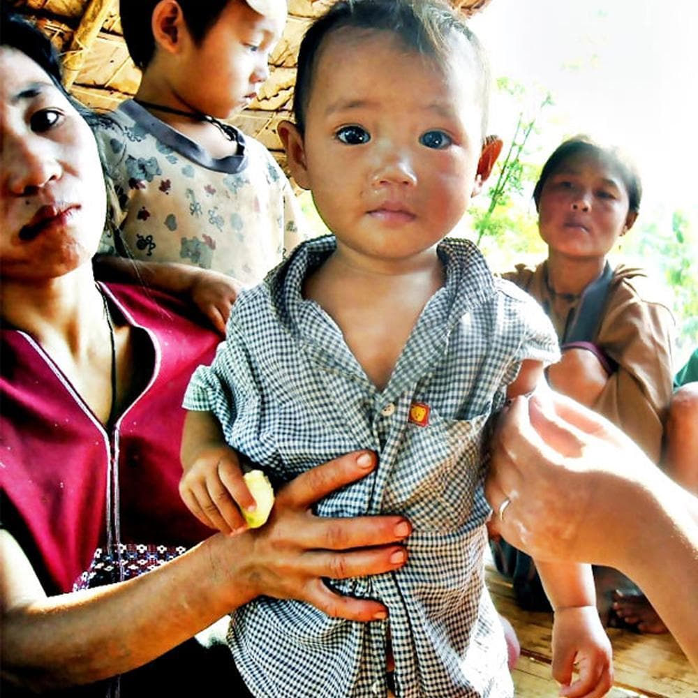 Donation - Help A Malnourished Child In Burma